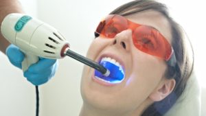 What Minor Treatments Do Cosmetic Dentists Provide Torrance