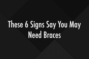 These 6 Signs Say You May Need Braces
