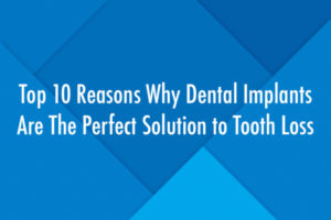 Top 10 Reasons Why Dental Implants Are The Perfect Solution to Tooth Loss