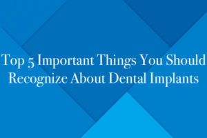 Top 5 Important Things You Should Recognize About Dental Implants